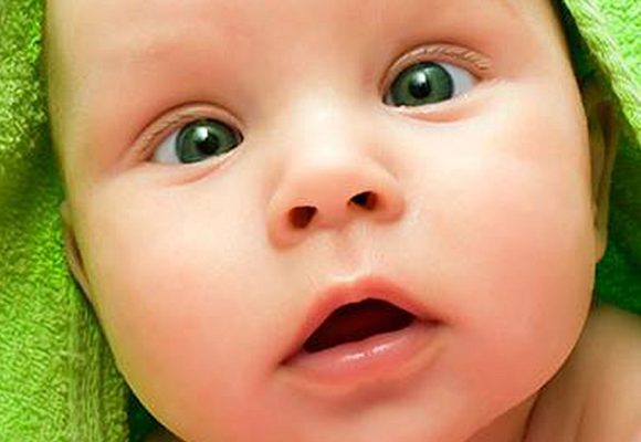 Estrabismo infantil: esotropia do lactente